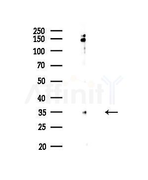 TNFSF10 Antibody - Western blot analysis of lysates from HepG2 cells(UV,30min treatment), using TNFSF10 Antibody at 1/1000 dilution.