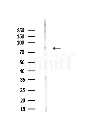 GAS2L1 Antibody - Western blot analysis of lysates from HUVEC cells(starvation,24h treatment), using GAS2L1 Antibody at 1/1000 dilution.