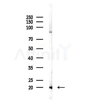 REG3G Antibody - Western blot analysis of lysates from HepG2 cells, using REG3G Antibody at 1/1000 dilution.