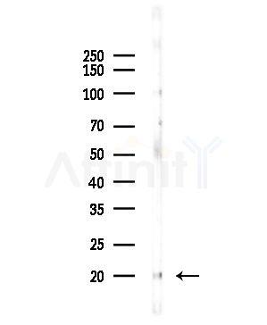 REG3G Antibody - Western blot analysis of lysates from COLO205 cells(UV,30min treatment), using REG3G Antibody at 1/1000 dilution.