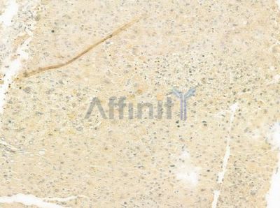 LETMD1 Antibody - DF6870 at 1/100 staining human normal liver tissue by IHC-P.
