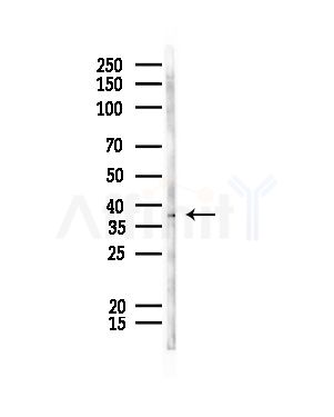 ELSPBP1 Antibody - Western blot analysis of lysates from Rat liver, using ELSPBP1 Antibody at 1/1000 dilution.