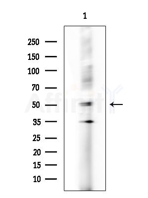 Cytochrome P450 19A1 Antibody - Western blot analysis of extracts from Hela cells(LPS 4h treatment), using Cytochrome P450 19A1 Antibody at 1/1000 dilution.