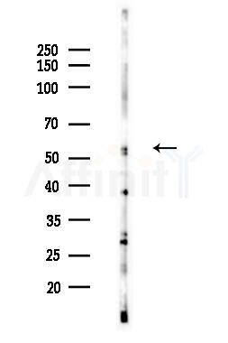 Cytochrome P450 19A1 Antibody - Western blot analysis of lysates from Hela cells(LPS 4h treatment), using Cytochrome P450 19A1 Antibody at 1/1000 dilution.