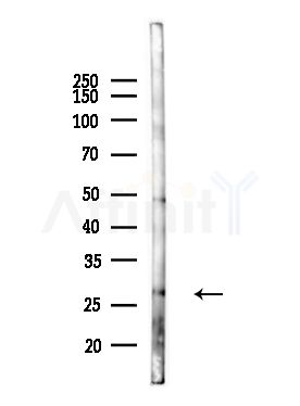 HLA-DQA1 Antibody - Western blot analysis of lysates from Mouse lung, using HLA-DQA1 Antibody at 1/1000 dilution.