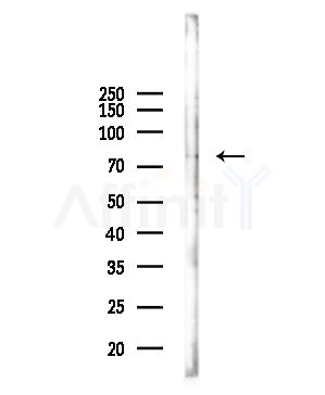 ITGB2/CD18 Antibody - Western blot analysis of lysates from Mouse lung, using ITGB2/CD18 Antibody at 1/1000 dilution.