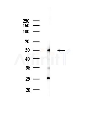 PPP2R2A Antibody - Western blot analysis of lysates from COLO205 cells, using PPP2R2A Antibody at 1/1000 dilution.