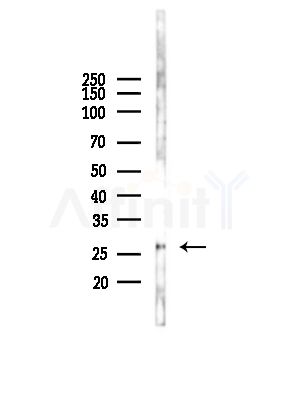 PSMA6 Antibody - Western blot analysis of lysates from COLO205 cells(UV,30min treatment), using PSMA6 Antibody at 1/1000 dilution.
