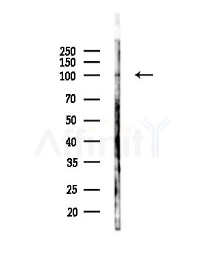 DLGAP5 Antibody - Western blot analysis of lysates from PC12 cells(LPS,4h treatment), using DLGAP5 Antibody at 1/1000 dilution.