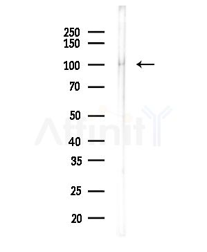 ABCC4 Antibody - Western blot analysis of lysates from COLO205 cells(heat-shock,45min treatment), using ABCC4 Antibody at 1/1000 dilution.