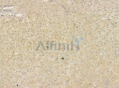 RAPGEF3 Antibody - DF6922 at 1/100 staining human normal liver tissue by IHC-P.