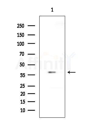 p50 Dynamitin Antibody - Western blot analysis of extracts from HepG2 cells(UV 30min treatment), using p50 Dynamitin Antibody at 1/1000 dilution.