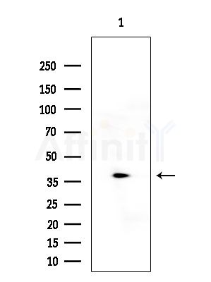 p50 Dynamitin Antibody - Western blot analysis of extracts from Rat brain, using p50 Dynamitin Antibody at 1/1000 dilution.