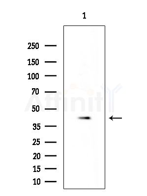 p50 Dynamitin Antibody - Western blot analysis of extracts from EC304 cells, using p50 Dynamitin Antibody at 1/1000 dilution.