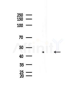 p50 Dynamitin Antibody - Western blot analysis of lysates from EC304 cells, using p50 Dynamitin Antibody at 1/1000 dilution.