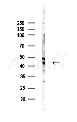 DNMT3L Antibody - Western blot analysis of lysates from MCF7 cells(heat-shock,45min treatment), using DNMT3L Antibody at 1/1000 dilution.