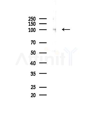 UHRF1 Antibody - Western blot analysis of lysates from HepG2 cells, using UHRF1 Antibody at 1/1000 dilution.