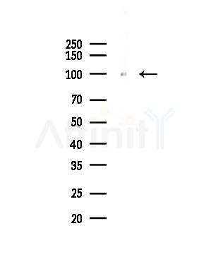 UHRF1 Antibody - Western blot analysis of lysates from COLO205 cells(UV,30min treatment), using UHRF1 Antibody at 1/1000 dilution.