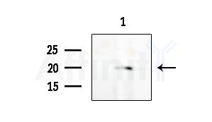 Tri-Methyl-Histone H3 (Lys4)/H3K4me3 Antibody - Western blot analysis of extracts from EC304 cells, using Tri-Methyl-Histone H3 (Lys4)/H3K4me3 Antibody at 1/1000 dilution.
