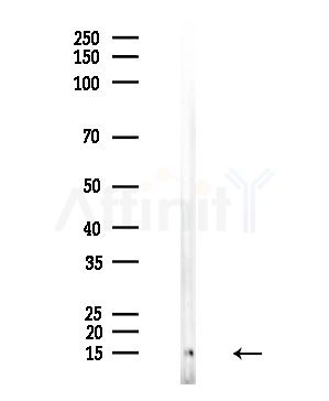 Tri-Methyl-Histone H3 (Lys4)/H3K4me3 Antibody - Western blot analysis of lysates from EC304 cells, using Tri-Methyl-Histone H3 (Lys4)/H3K4me3 Antibody at 1/1000 dilution.