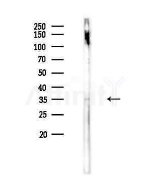 P2RY6 Antibody - Western blot analysis of lysates from HepG2 cells(UV,30min treatment), using P2RY6 Antibody at 1/1000 dilution.
