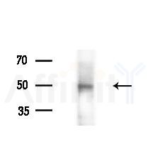 AP2M1 Antibody - Western blot analysis of lysates from various samples, using AP2M1 Antibody at 1/1000 dilution.