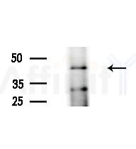 AP2M1 Antibody - Western blot analysis of lysates from EC304 cells
(heat-shock treatment), using AP2M1 Antibody at 1/1000 dilution.