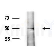 AP2M1 Antibody - Western blot analysis of lysates from Mouse testis, using AP2M1 Antibody at 1/1000 dilution.