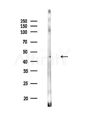 AP2M1 Antibody - Western blot analysis of lysates from Mouse testis, using AP2M1 Antibody at 1/1000 dilution.