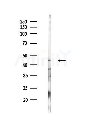 AP2M1 Antibody - Western blot analysis of lysates from EC304 cells(heat-shock treatment), using AP2M1 Antibody at 1/1000 dilution.