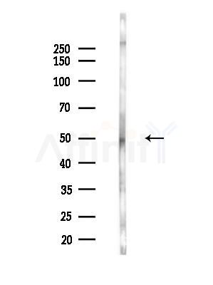 AP2M1 Antibody - Western blot analysis of lysates from B16F10-LUC cells(LPS,4h treatment), using AP2M1 Antibody at 1/1000 dilution.