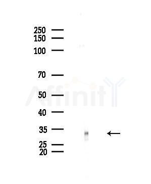 SIAH1 Antibody - Western blot analysis of lysates from EC304 cells, using SIAH1 Antibody at 1/1000 dilution.