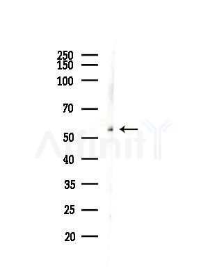 NUP62 Antibody - Western blot analysis of lysates from LoVo cells(heat-shock,45min treatment), using NUP62 Antibody at 1/1000 dilution.