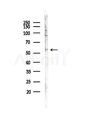 NUP62 Antibody - Western blot analysis of lysates from MDA-MB-231 cells(heat-shock,45min treatment), using NUP62 Antibody at 1/1000 dilution.
