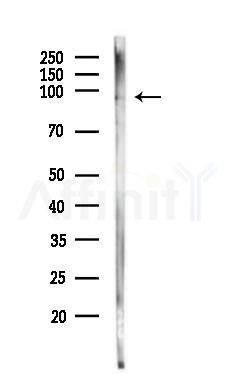 TTK Antibody - Western blot analysis of lysates from Raji cells(heat-shock,45min treatment), using TTK Antibody at 1/1000 dilution.