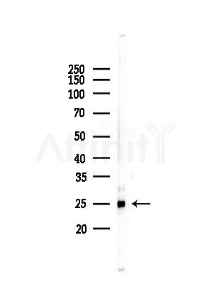 PSMA2 Antibody - Western blot analysis of lysates from RAW264.