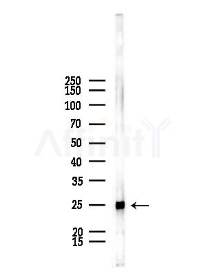 PSMA2 Antibody - Western blot analysis of lysates from Mouse lung, using PSMA2 Antibody at 1/1000 dilution.