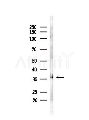 EEF1D Antibody - Western blot analysis of lysates from LoVo cells(heat-shock,45min treatment), using EEF1D Antibody at 1/1000 dilution.