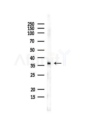 EEF1D Antibody - Western blot analysis of lysates from Rat liver, using EEF1D Antibody at 1/1000 dilution.