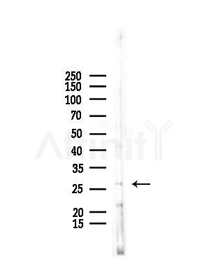 PSMA4 Antibody - Western blot analysis of lysates from COLO205 cells, using PSMA4 Antibody at 1/1000 dilution.