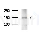 TCOF1 Antibody - Western blot analysis of extracts from Mouse brain, using TCOF1 Antibody at 1/1000 dilution.