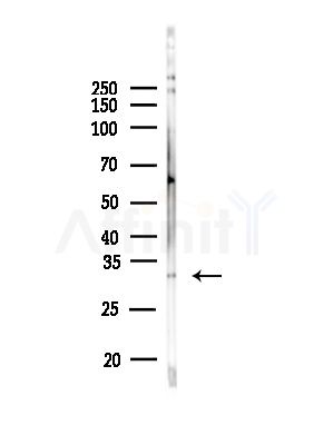 HAVCR2 Antibody - Western blot analysis of lysates from Mouse testis, using HAVCR2 Antibody at 1/1000 dilution.