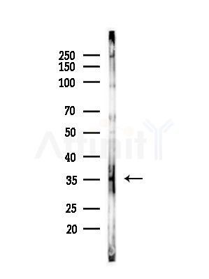 HNMT Antibody - Western blot analysis of lysates from HepG2 cells(LPS,4h treatment), using HNMT Antibody at 1/1000 dilution.