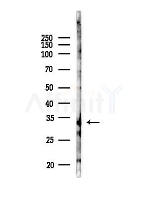 HNMT Antibody - Western blot analysis of lysates from RAW264.