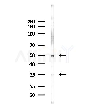 DKK3 Antibody - Western blot analysis of lysates from Hela cells(LPS,4h treatment), using DKK3 Antibody at 1/1000 dilution.