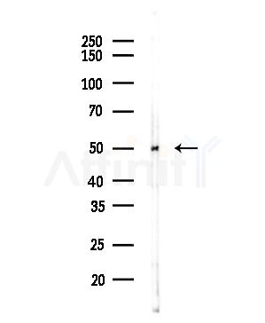 DKK3 Antibody - Western blot analysis of lysates from COLO205 cells(heat-shock,45min treatment), using DKK3 Antibody at 1/1000 dilution.