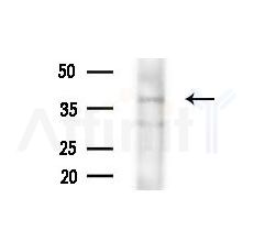 ACP5 Antibody - Western blot analysis of lysates from RAW264.