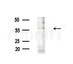 ACP5 Antibody - Western blot analysis of lysates from B16F10-LUC cells(heat-shock,45min treatment), using ACP5 Antibody at 1/1000 dilution.