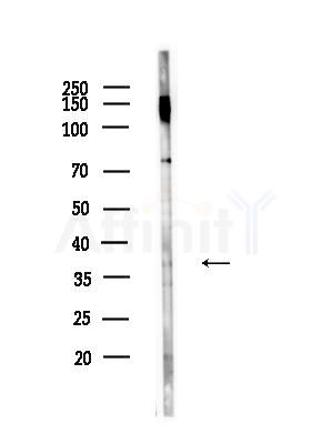 ACP5 Antibody - Western blot analysis of lysates from RAW264.
