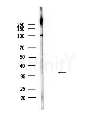 ACP5 Antibody - Western blot analysis of lysates from B16F10-LUC cells(heat-shock,45min treatment), using ACP5 Antibody at 1/1000 dilution.